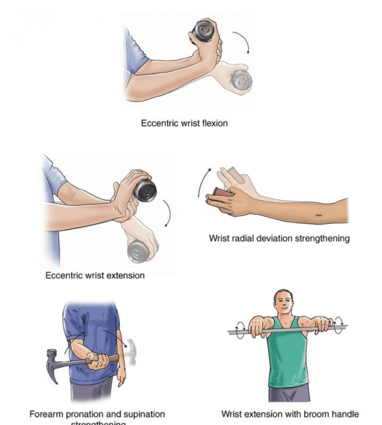 Exercises For Elbow Pain | GMphysio
