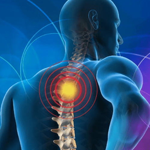 Upper back pain - Upper back - Manchester Physio - Leading